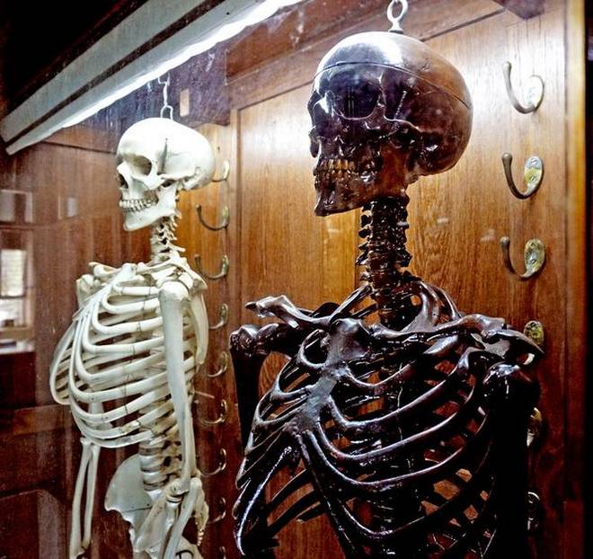 The ivory and rosewood skeletons on display at the AMC’s Anatomy Museum in Visakhapatnam. | Photo Credit: C.V.Subrahmanyam